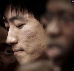 有痘坑男明星,揭秘有痘坑男明星的蜕变之路